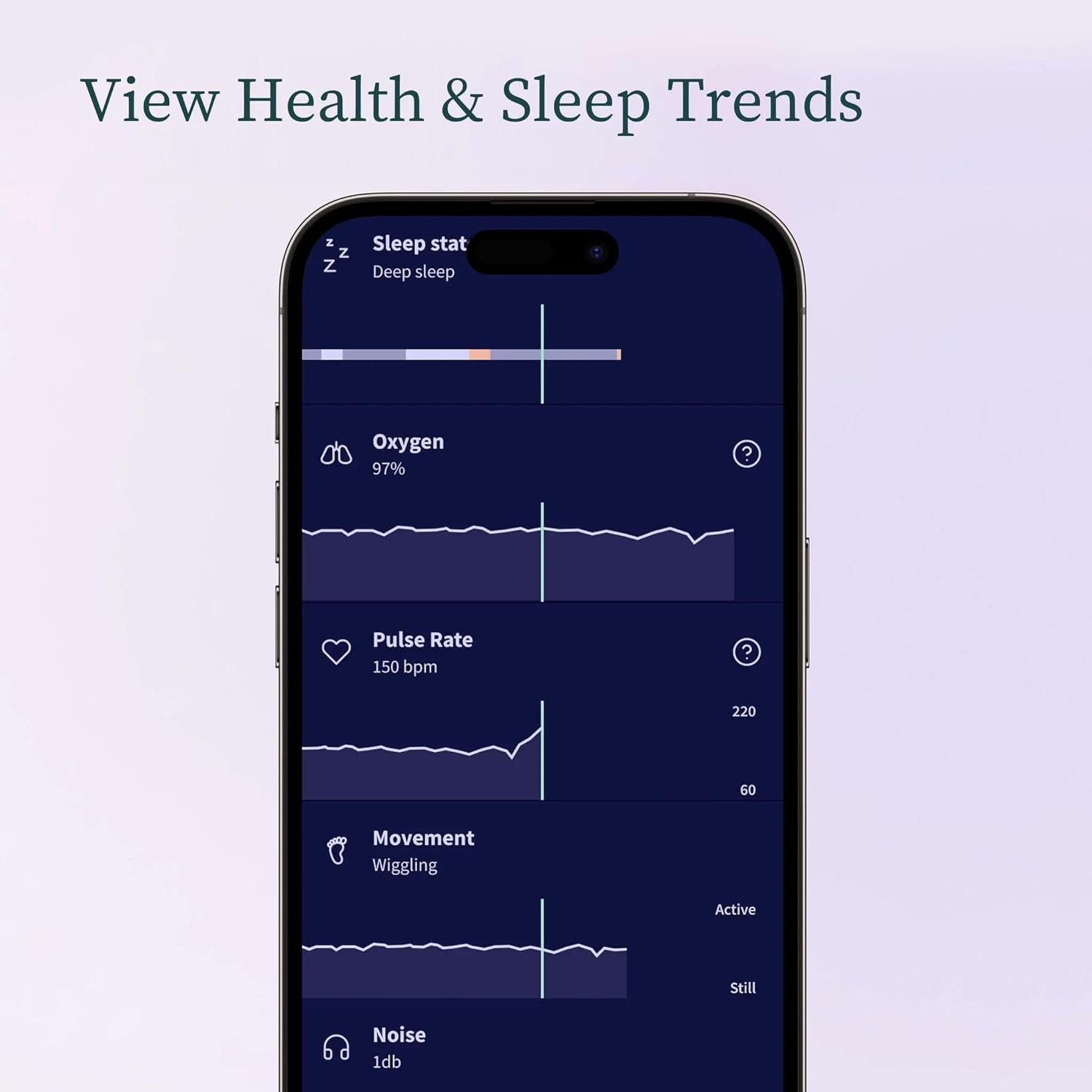 Owlet Dream Sock Smart Baby Monitor